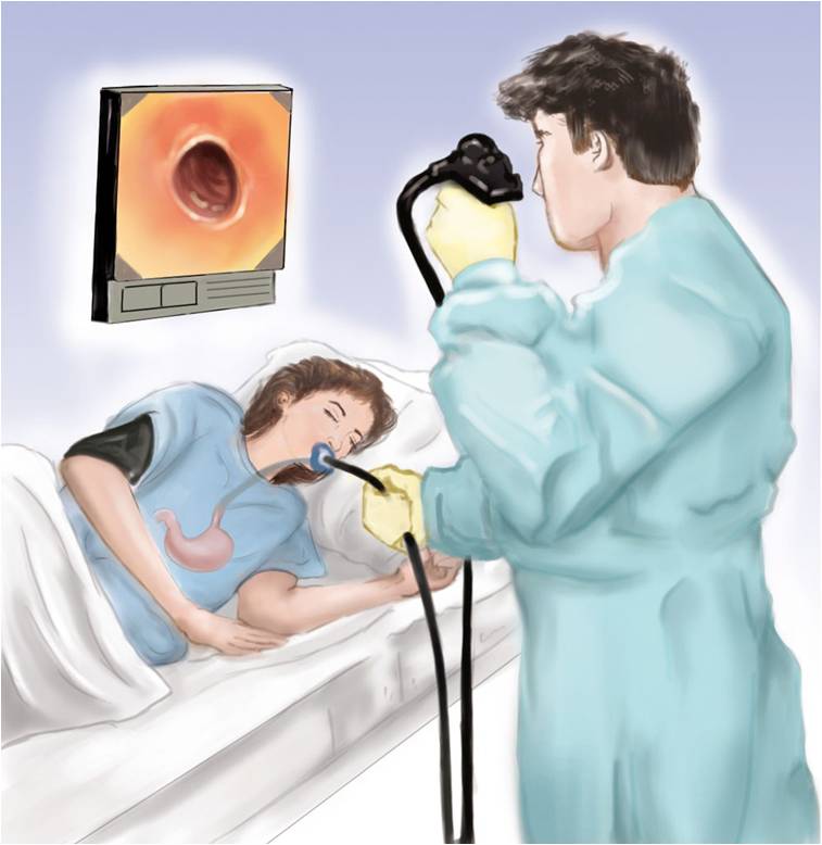Endoscopia digestiva alta